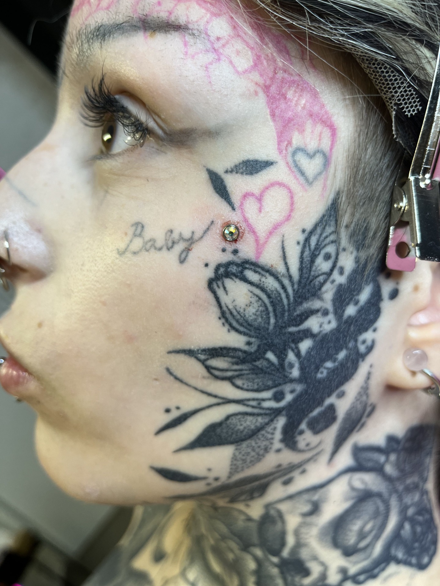 kvalitní mikrodermál